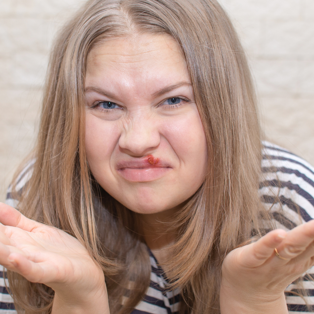 Home Remedy for Cold Sore: Soothing Relief with "Cold Be Gone Tea"