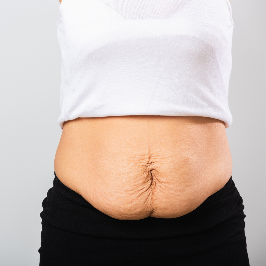 Postpartum Weight Loss