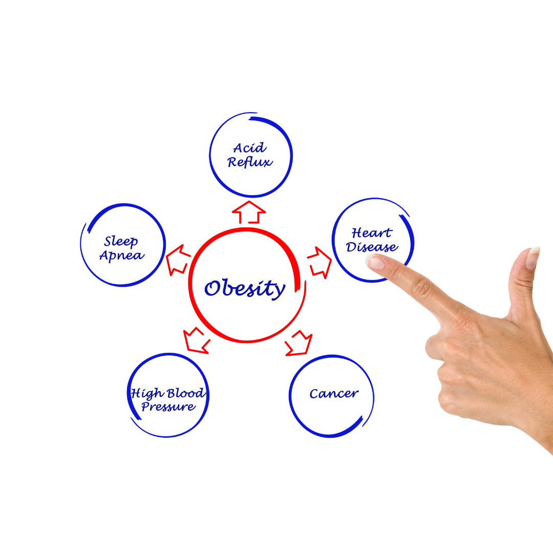 obesity diagram